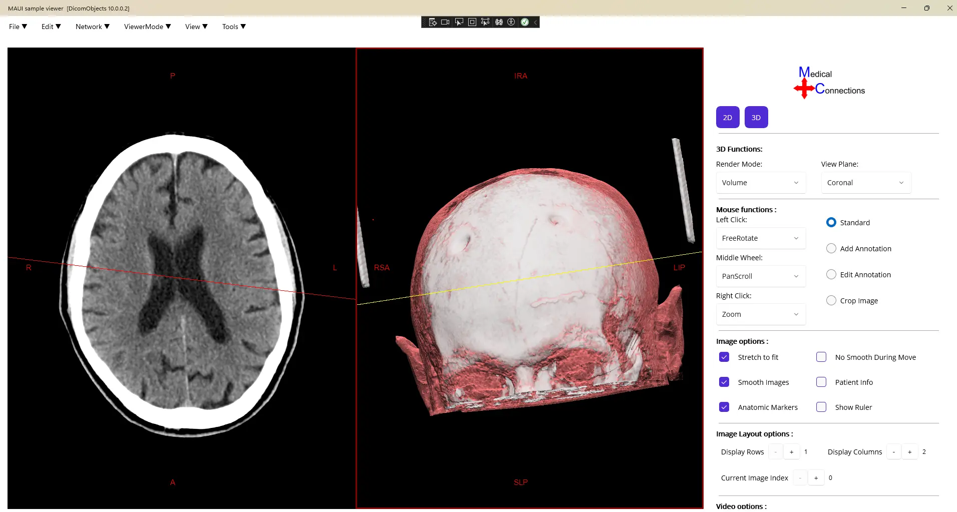 DicomObjects.NET10 MAUI sample viewer showing GPU rendering and 3D rendering support